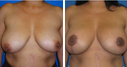 Before & After Photos